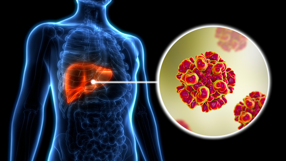 হেপাটাইটিস ‘ই’ এর ভয়াবহতা, ওষুধ আবিষ্কার : বাঁচতে হলে জানতে হবে